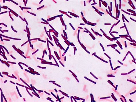 Microbiology Are Acid Fast Bacteria Gram Positive Or Gram Negative