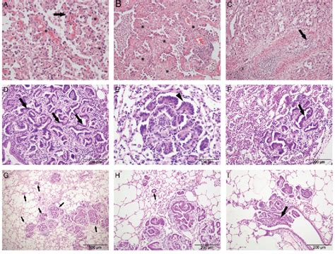 Histological Appearance Of Human Lung Adenocarcinoma And Opa