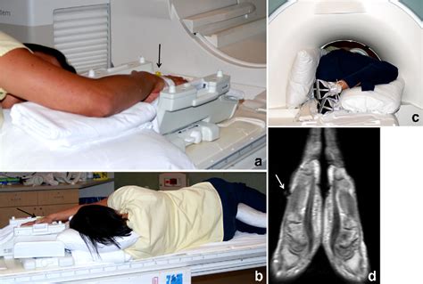 Mri And Ultrasound Of The Hands And Wrists In Rheumatoid Arthritis I