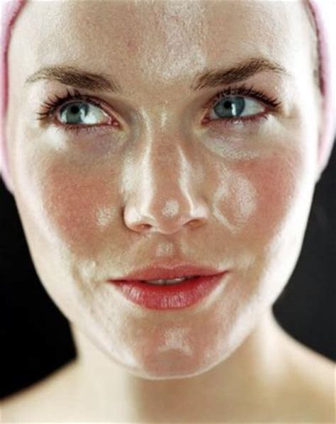Extremely Oily Skin Pictures Photos