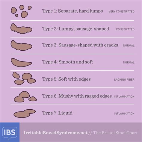 Types Of Bowel Movements Chart Images And Photos Finder