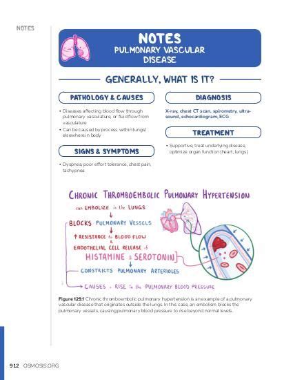 Pulmonary Edema Video Anatomy Definition And Function Osmosis