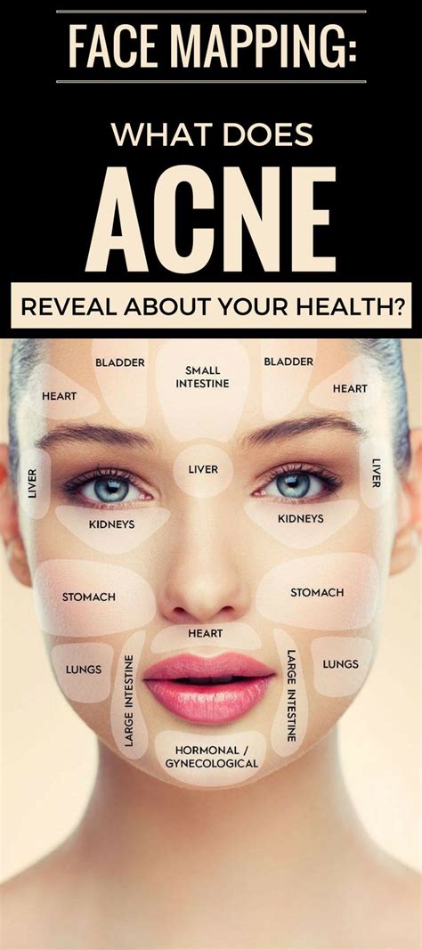 Face Mapping What Does Acne Reveal About Your Health Skin Care