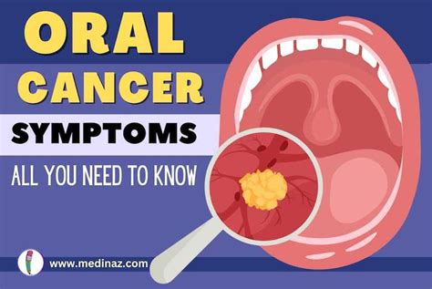 oral cancer symptoms all you need to know