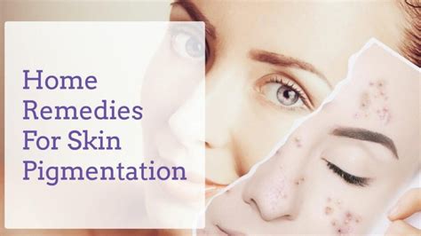 Home Remedies For Skin Pigmentation Skin Care Top News