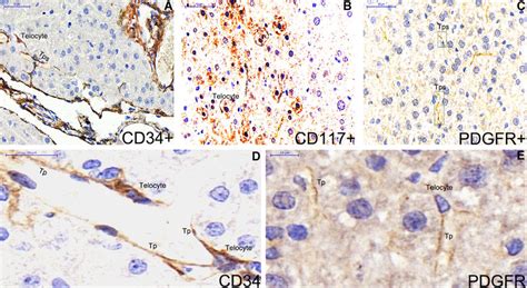 Single Label Immunohistochemistry For Cd34 Cd117 And Pdgfr α Are