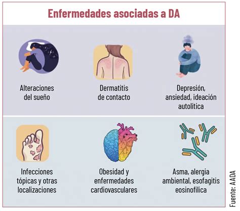 Dermatitis Atópica Enfermedad Que Va Más Allá De La Piel