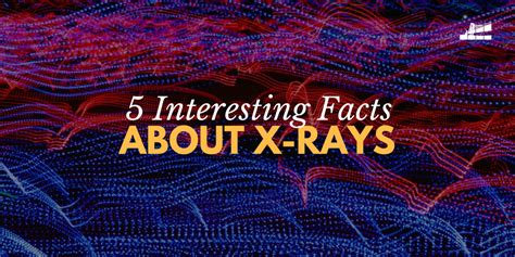 5 Interesting Facts About X Rays — Bay Imaging Consultants