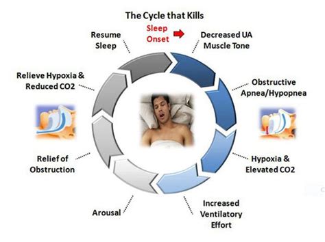 know the facts about sleep apnea pasadena tx apnea doctors