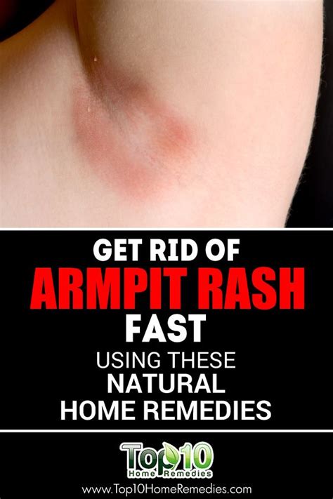25 Best Ideas About Armpit Rash On Pinterest Baking Soda Deodorant