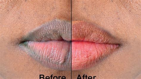 Lips Here Are 5 Naturally Ways To Make Them Soft And Pink Pulse Nigeria