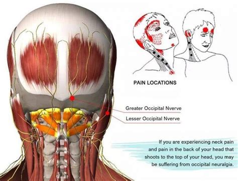 Occipital Nerve Distribution