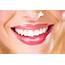 Different Types Of Staining Teeth Whitening Can Help  Alpharetta GA