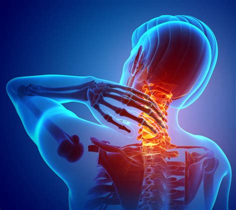Neck Injury And Pain After A Car Accident Presser Law Pa