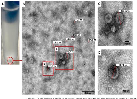 figure 1 from characterization of extracellular vesicles secreted by a clinical isolate of