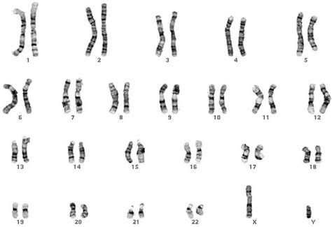 32 Chromosomes The Biology Classroom