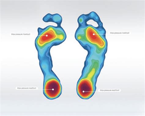 Aetrex Foot Scanner Golden State Orthopedics And Spine