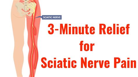 Uncover Specialized Processes To Rectify Sciatica Nerve Zone