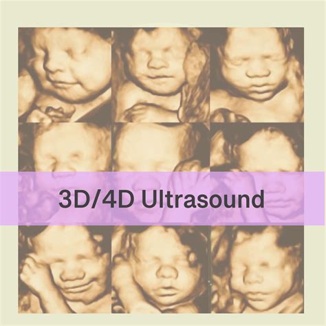 3d 4d ultrasound near me