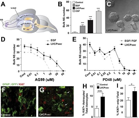 Age Dependent Niche Signals From The Choroid Plexus Regulate Adult