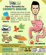 Pictures of Home Remedies