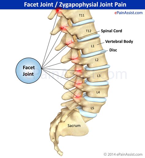 sex correction of the spine and joints