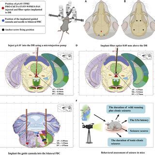 The Implantation Of Optical Fiber In Dr And Icv Guide Cannula A The