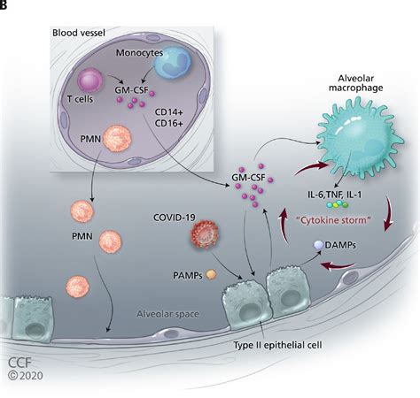 Cytokine Storm Release Syndrome And The Prospects For Immunotherapy