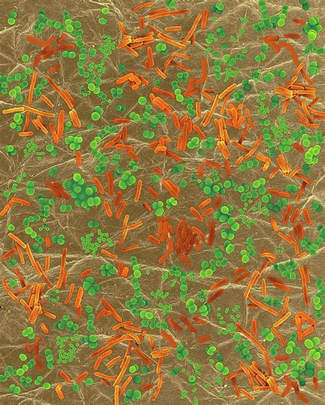 Bacteria On Human Skin 2 Photograph By Dennis Kunkel Microscopy