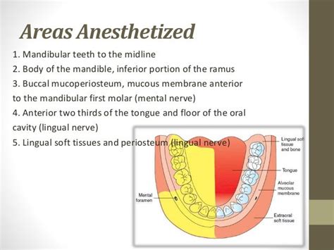 Dental Anesthesia Tips For Successful Mandibular Block
