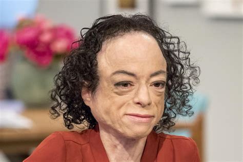 Silent Witness Actress Liz Carr Speaks Out After Being Stabbed In The
