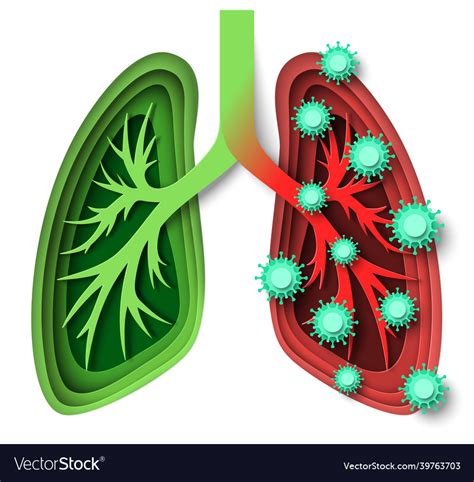Human Lungs Healthy And Infected With Virus Vector Image