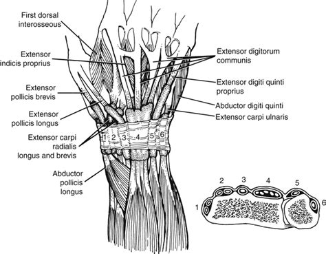 Extensor Tendon Injury Musculoskeletal Key