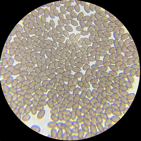 Five Priceless Classes About Psychedelic Mushroom Spores That you’re