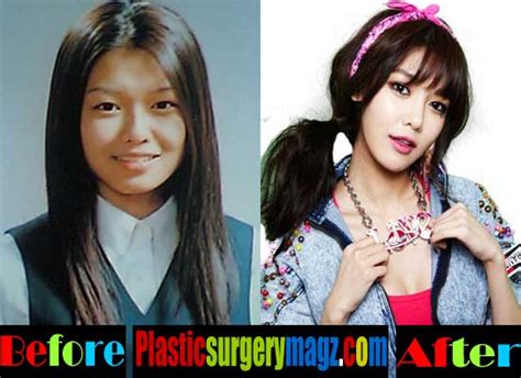 Girls Generation Plastic Surgery Is Finally Revealed Plastic Surgery Magazine