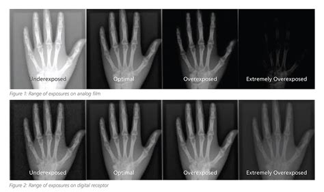 CLO 3 Assess Radiographic Exposure On Radiographic Images