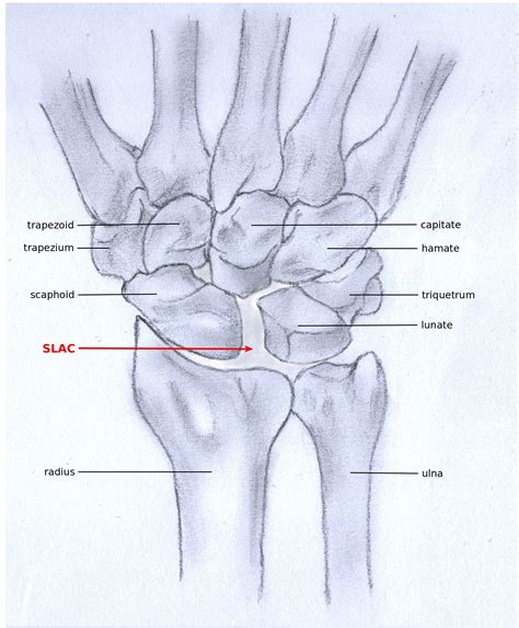 Wrist Joint Radiocarpal Joint
