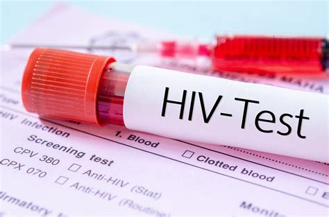 Hiv Testing Pictures