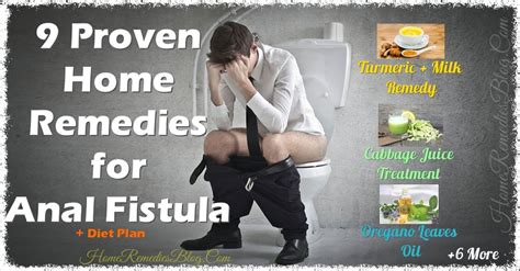 9 Proven Home Remedies For Anal Fistula With Diet Plan