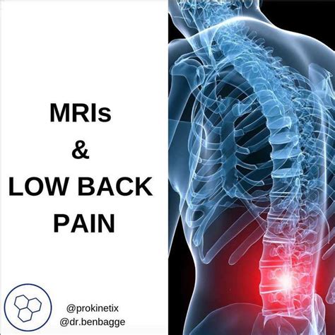 Mris And Low Back Pain Prokinetix Physical Therapy And Performance