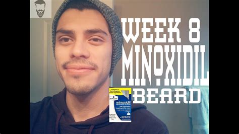The results have been slow but i'm trusting the process and going strong. Minoxidil beard week 8 (2 months) - YouTube