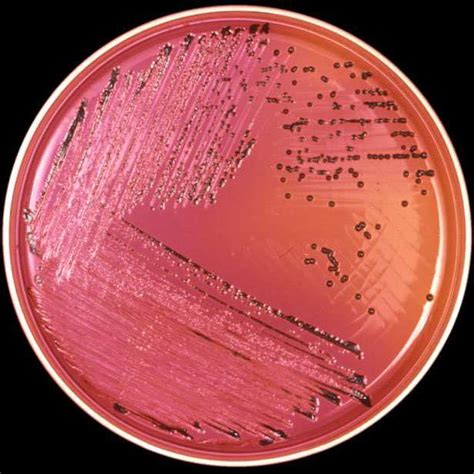1 Salmonella Spp On Xld Agar Download Scientific Diagram