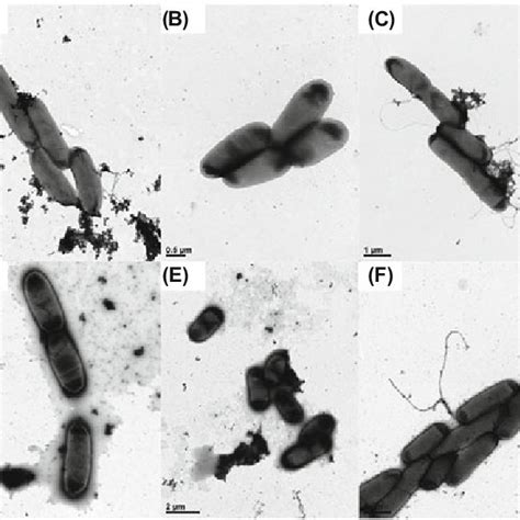 A F Transmission Electron Microscopy Tem Images Of Wildtype