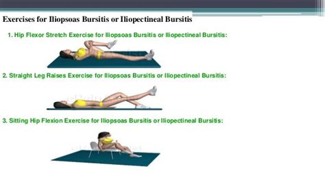 Iliopsoas Bursitis Exercises