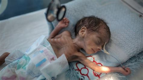 Unicef Millions Of Yemeni Children May Starve Amid Pandemic Kx News
