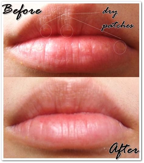 Journey On Beauty Tonymoly Kiss Kiss Lovely Lip Patch Review