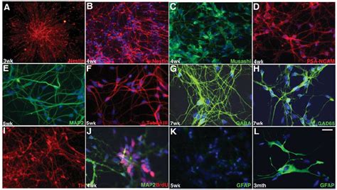 Characterization Of Hesc Derived Neural Progenitors And Neurons By