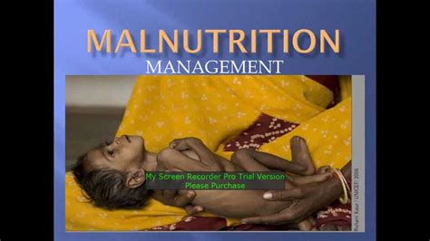 Malnutrition A Major Health Problem Its Diagnosis And Treatment