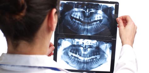 How Safe Are Dental X Rays Western Prosthodontic Centre