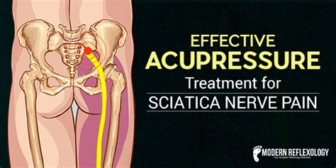 Acupressure points for sciatica pain. 4 Simple Acupressure Points to Treat Sciatica Nerve Pain ...